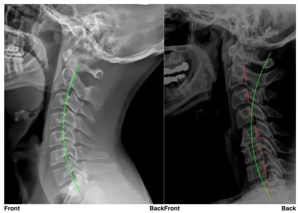 postureray x-ray circadian