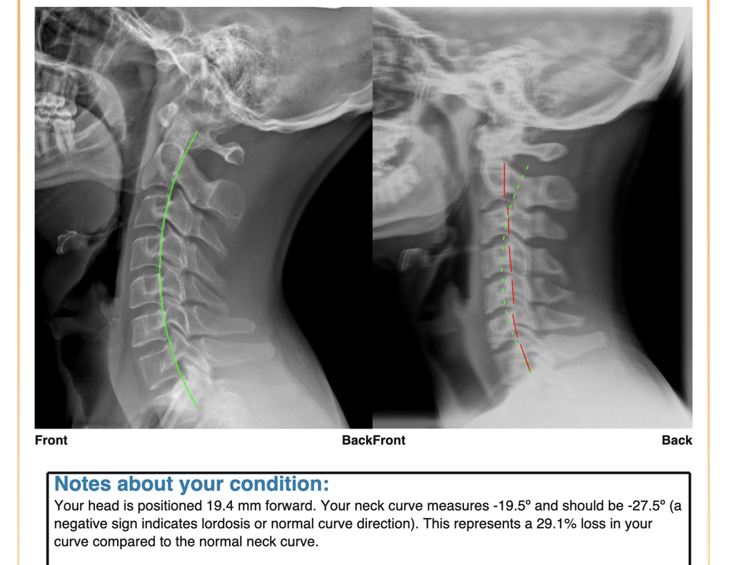 tos x ray